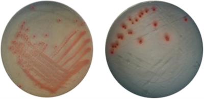 Induction of Viable but Nonculturable Escherichia coli O157:H7 by Low Temperature and Its Resuscitation